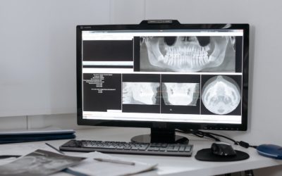 Odontología osteopatizada, cómo y por qué